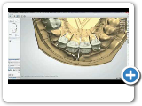 Dental System™ 2012 - Smile Composer™