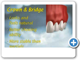 Ponciano Dental - Tooth Options.wmv