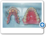 Ponciano Dental - Orthodontics.wmv