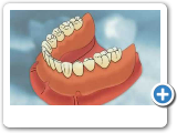 Ponciano Dental - Full Dentures.wmv