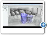 Dental System™ 2012 - Model Builder™