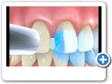 Ponciano Dental - Cosmetic Dentistry.wmv
